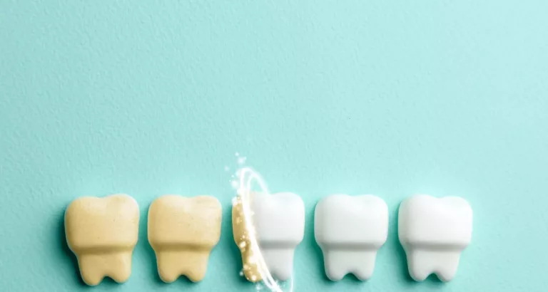 Comment avoir les dents blanches ?