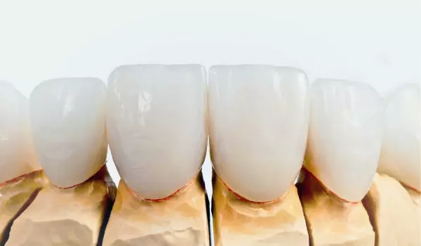 comment avoir les dents blanches
