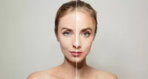 Peau Granuleuse : Comment Dire Adieu aux Aspérités ?